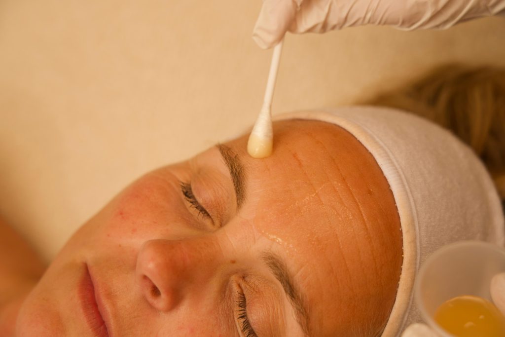 MB Haarlem fruitzuur peeling