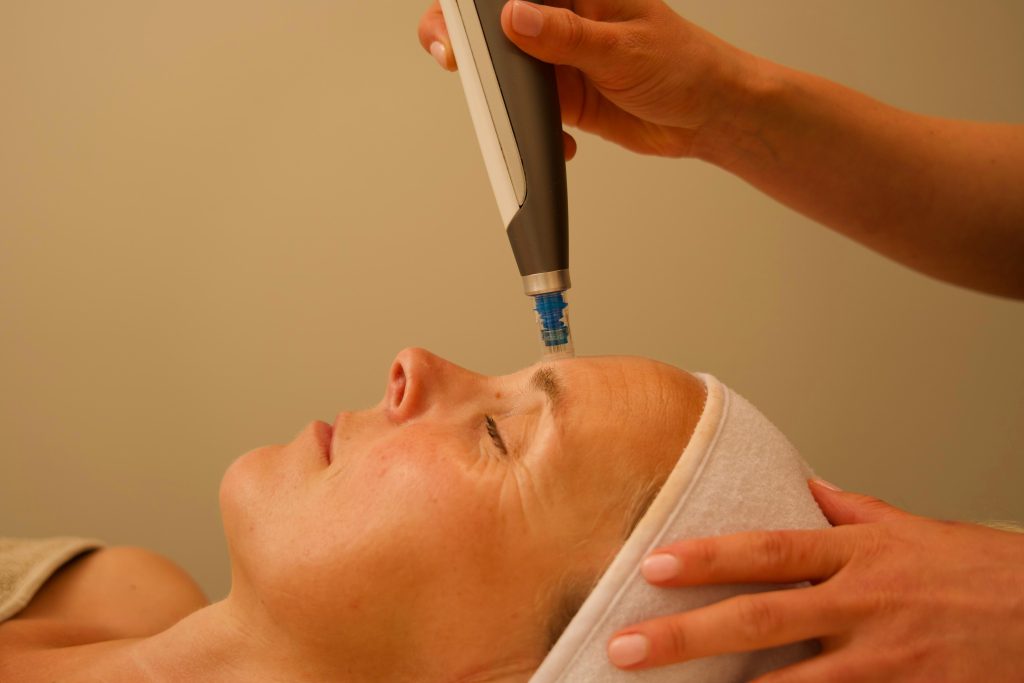 Microneedling MB Haarlem