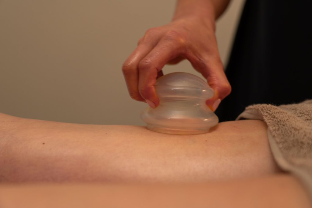 Cupping lichaam MB Haarlem